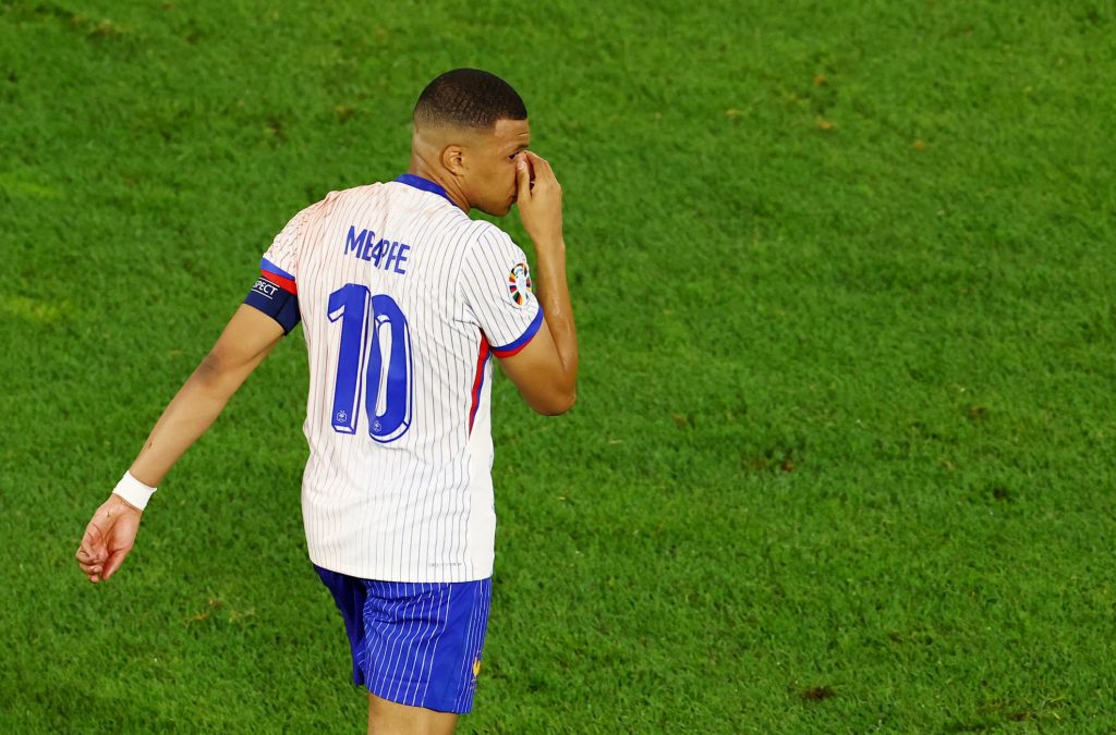 Azarkeşlər burnu sınan Mbappe ilə zarafatlaşdılar - FOTOLAR