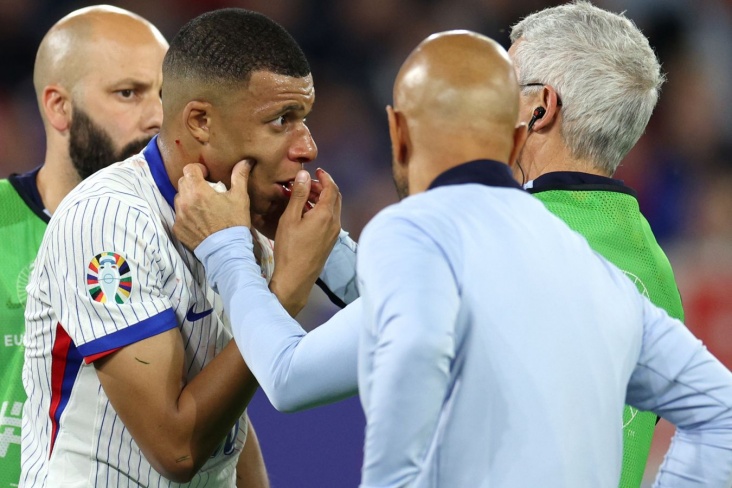 Mbappe yoldaşlıq görüşündə xüsusi maskada oynadı, dubl etdi