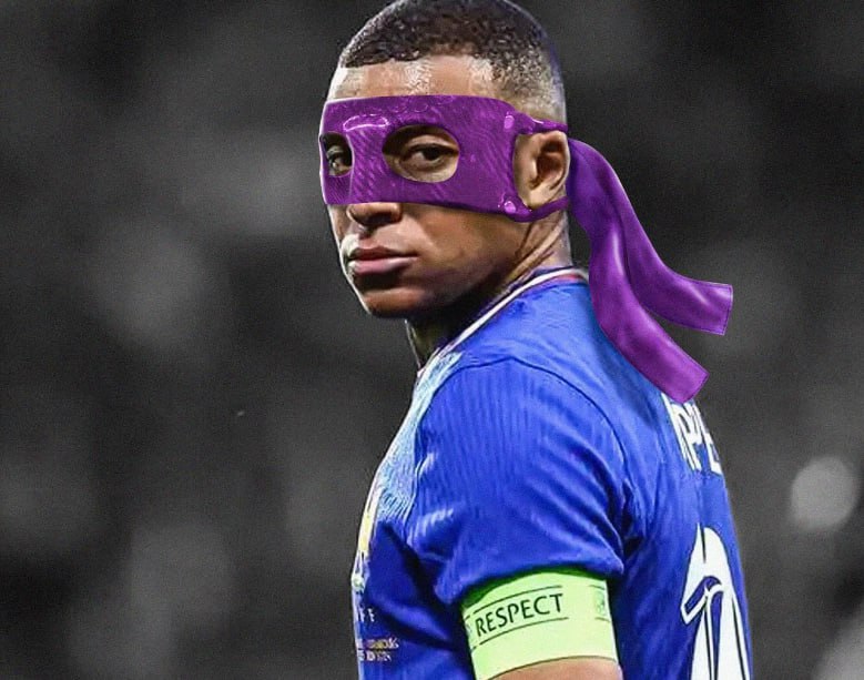 Azarkeşlər burnu sınan Mbappe ilə zarafatlaşdılar - FOTOLAR 3 Azarkeşlər burnu sınan Mbappe ilə zarafatlaşdılar - FOTOLAR
