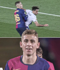 “Barsa”nın daha bir futbolçusu dişini sındırdı – FOTO